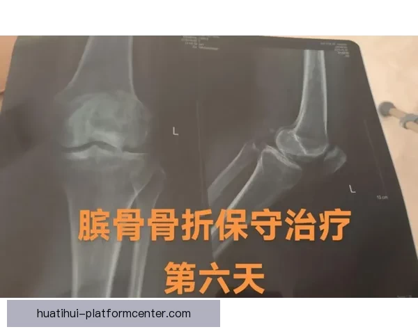 穆迪受伤可能影响下赛季复出队医称髌骨肌腱问题严重